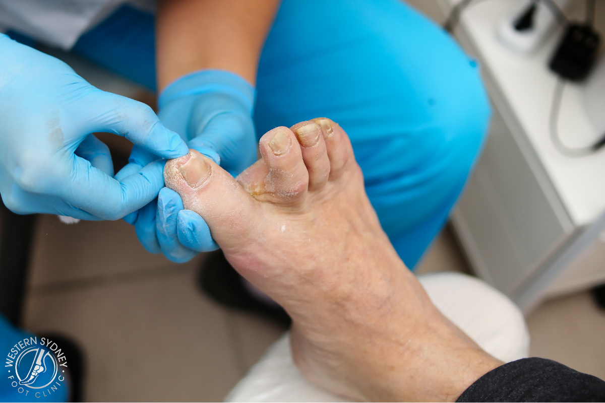 Western Sydney Foot Clinic Podiatry