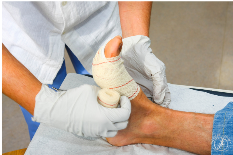 Untitled design 19 Mobile Podiatry for NDIS Patients