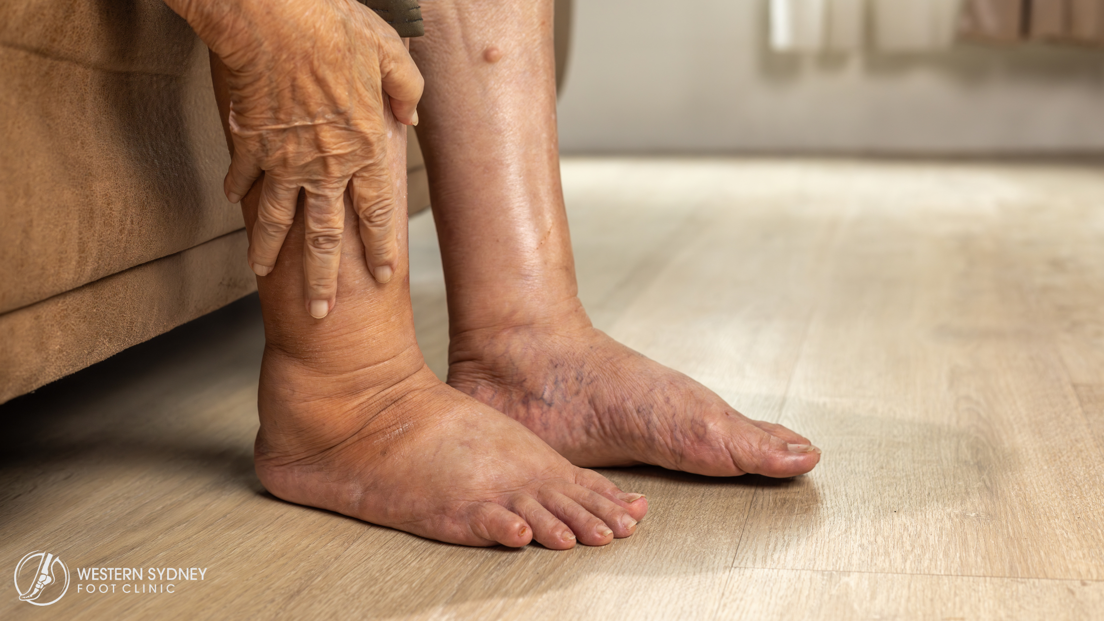 Untitled design 29 Diabetes Foot Health